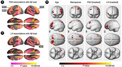 Elevated gonadotropin levels are associated with increased biomarker risk of Alzheimer's disease in midlife women